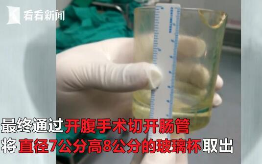 杯具！男子肛门塞进直径7厘米玻璃杯 医生开腹取出