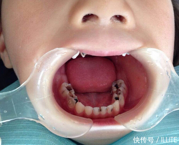 为什么贵州人的标签就是穷牙齿黄呢?