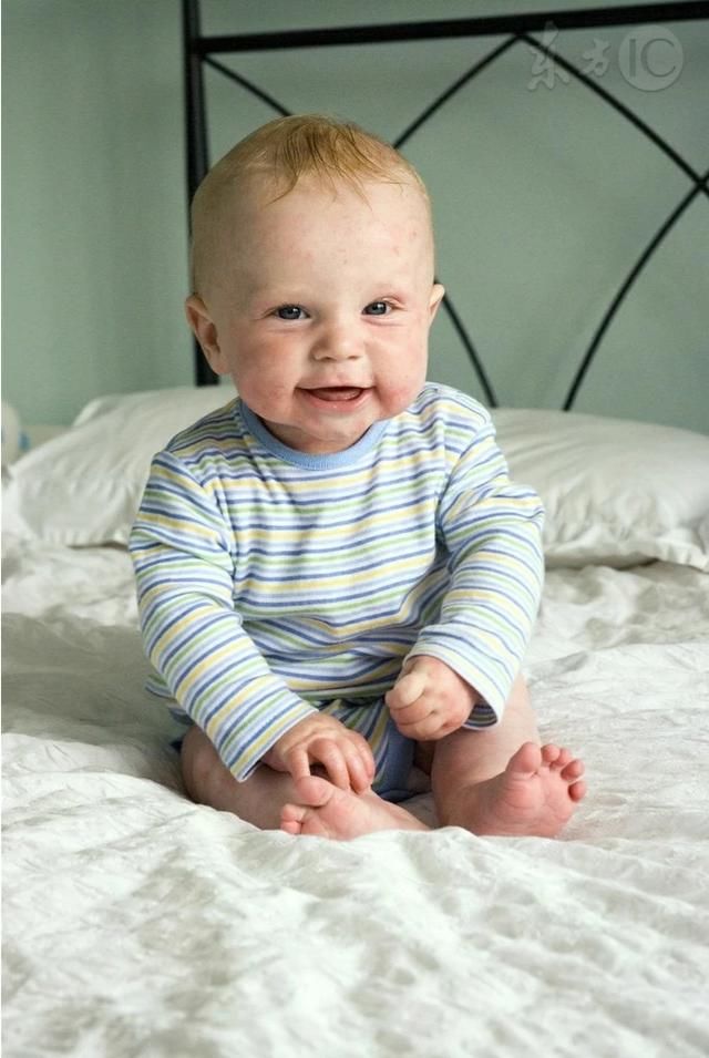 湿疹宝宝要多大才能好而又不会复发?