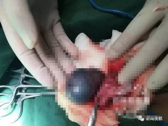 走路只能撅屁股 男孩 走路只能撅屁股 男孩