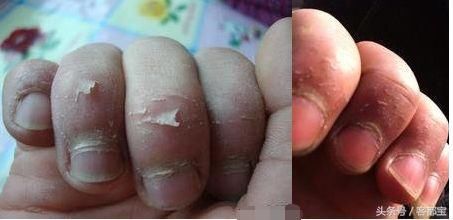 孩子有这5种表现,已经缺锌严重,再不补锌就来不及了家长需重视