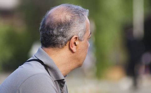 中医分型治脱发 看你适合哪一种