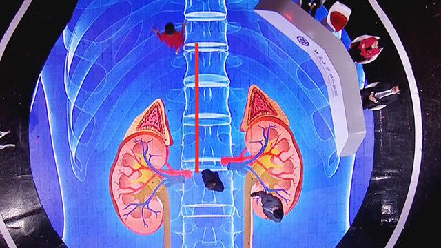《养生堂》20180106 老年人害怕的三件事 《养生堂》20180106 老年人害怕的三件事