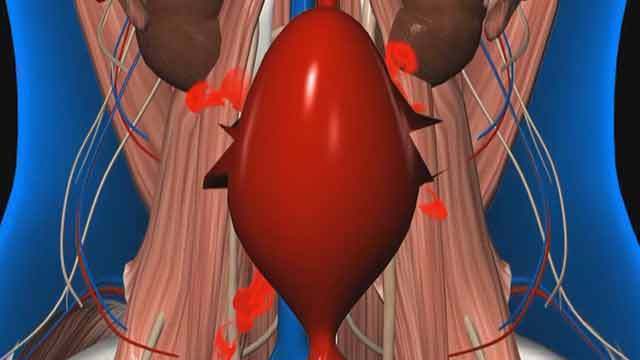 《生命缘》20190819血战