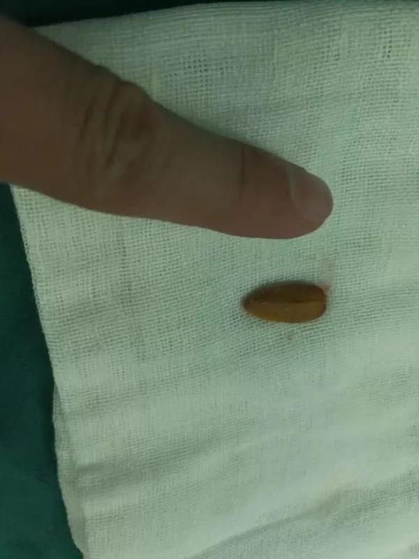 辽宁2岁男孩,险因咳嗽丧命!医生说,这个病正