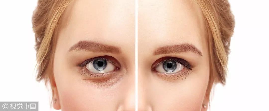 娜扎走搞笑风狂圈粉,然而她的黑眼圈出卖了一