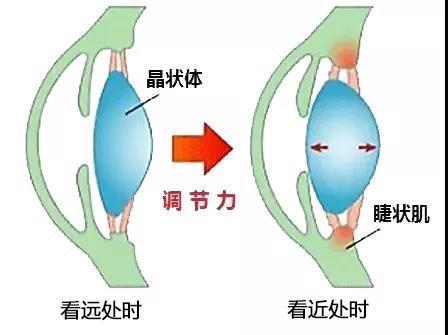 铜仁八中学生:假性近视怎么变成真性近视的?如