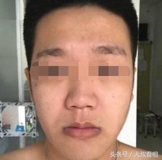 这里长痣的人,天生就是好命,一辈子有享不完的