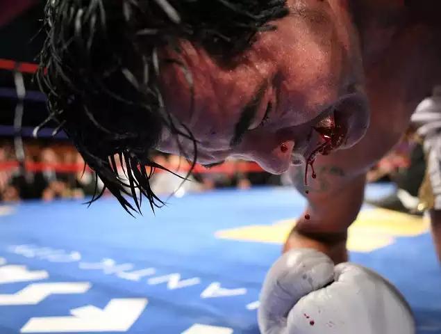 拳击比赛受伤图片