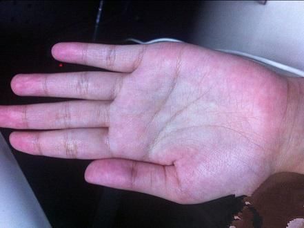 肝不好,蒲公英换个方法泡水喝,把肝脏泡净,肝