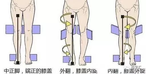 【体态纠正】小腹凸出、驼背、屁股下垂.这些