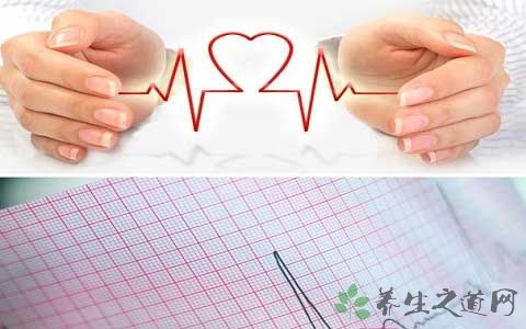 一度房室传导阻滞不能吃什么,一度房室传导阻