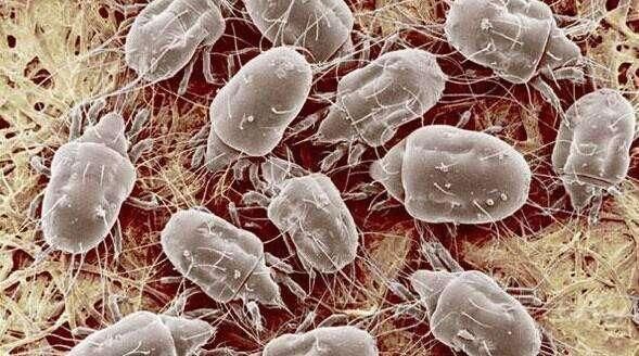 满脸痘痘遮不住,都是螨虫在作怪,粉粉加它敷脸祛痘不反复