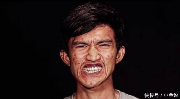 男子因长相太丑与女友分手,赴韩国整容后,女友