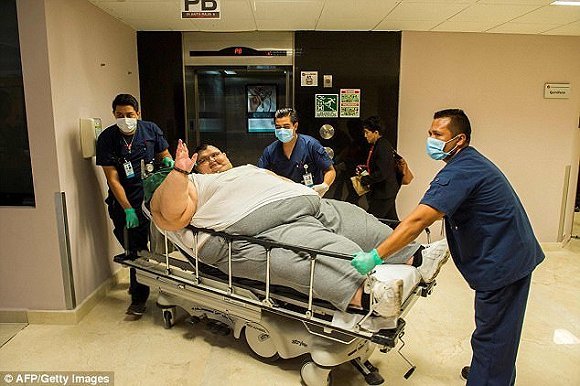 世界上最胖的男子减掉336斤体重出院了,什么手术效果这么神?