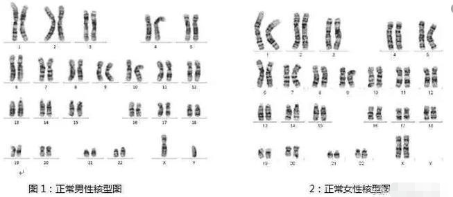 色盲或色弱可以通过第三代试管婴儿技术生育健