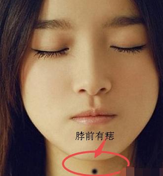痣相:脖子上的痣你知道有什么寓意吗?
