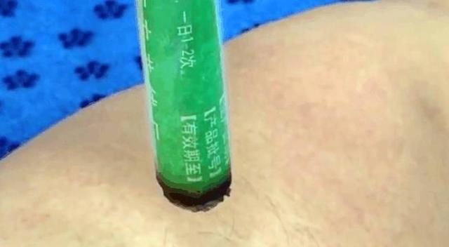 想要降低血糖,疏通经络很重要,阴市穴就是中医