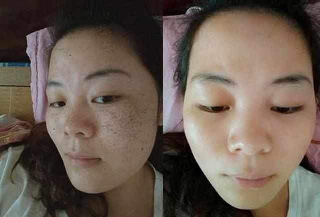 皮肤科主任温馨提醒,每天用它洗脸三次,祛斑、