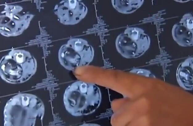 两岁半儿子恶心呕吐 母亲送到医院检查 听到检