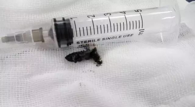 爸妈注意!宝宝睡觉打呼变呼噜娃,可能是这些