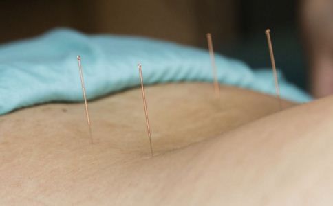科学针灸能养生 但也不能常常扎