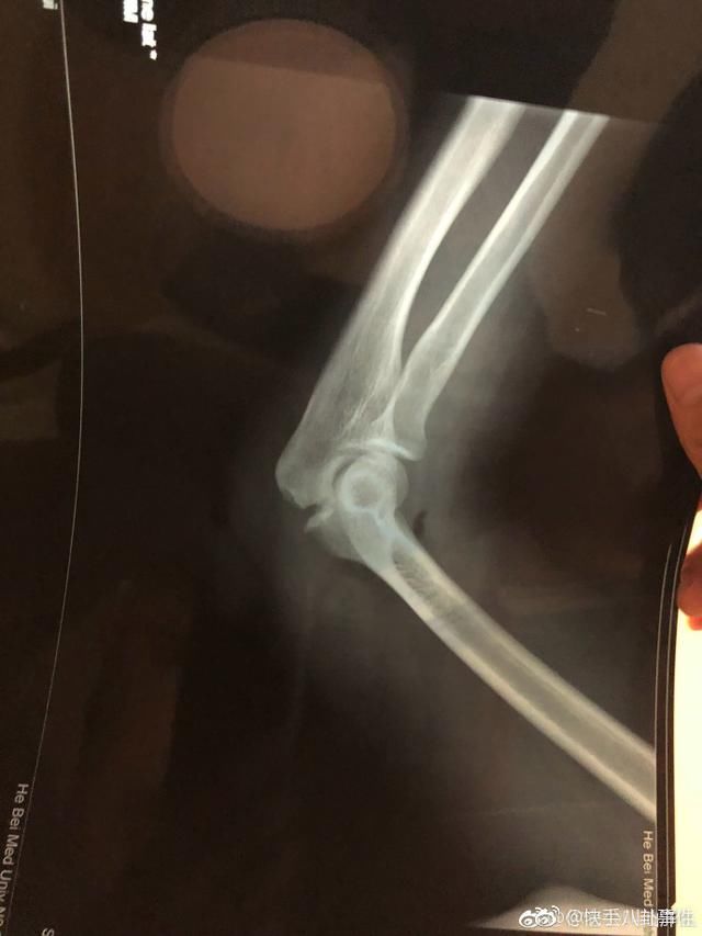 仙洋微博回应吴迪结婚和巴扎黑事件