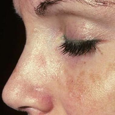 女人三十脸色就蜡黄,脸色不好别担心,常吃这几物排毒更有女人味