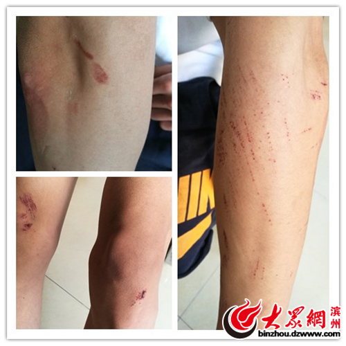 大学生情侣校园搂抱被查遭围殴 涉事学生被处分