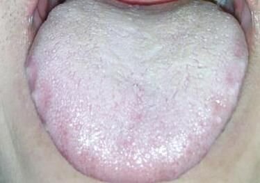 减肥必须先除湿气,小肚子瘦出马甲线。