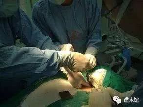 颈椎病,牵引、针刀、手术,知道你在干什么吗?