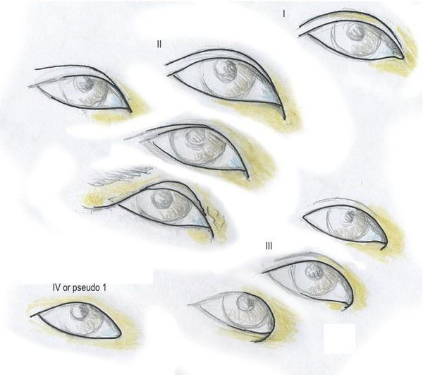 t01ffccea865d39de69.jpg?size=600x531