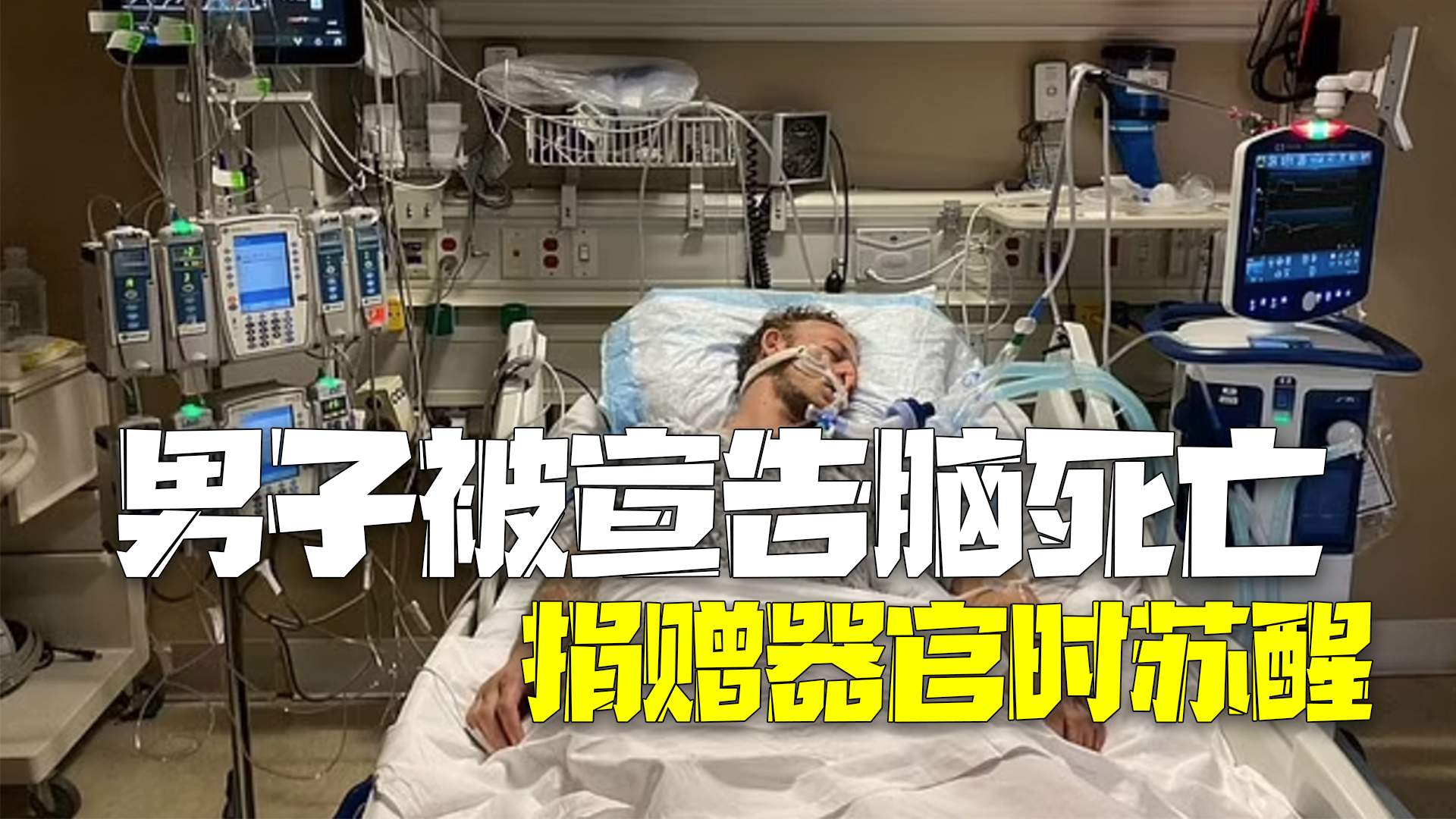 美国男子被宣告脑死亡捐赠器官 手术中苏醒疼得大声哭泣