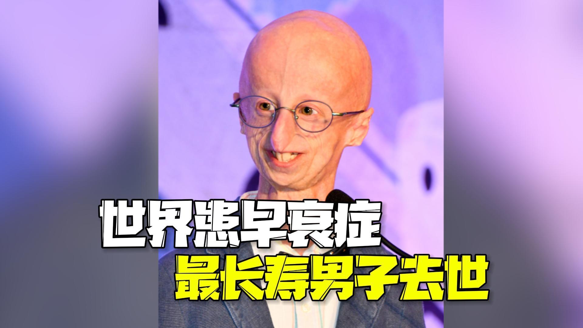 世界患早衰症最长寿男子去世终年28岁 曾获两所大学学位 世界患早衰症最长寿男子去世终年28岁 曾获两所大学学位