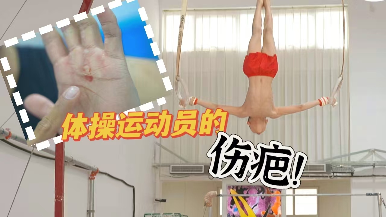 体操运动员第一关——要磨出手茧才能练