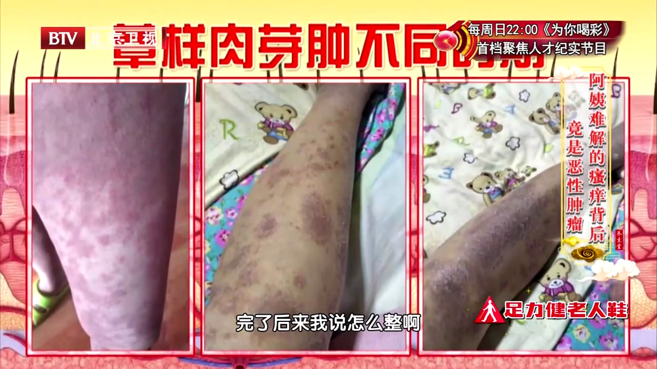 79岁阿姨皮肤瘙痒难解，背后竟是严重疾病，中医治疗一年痊愈