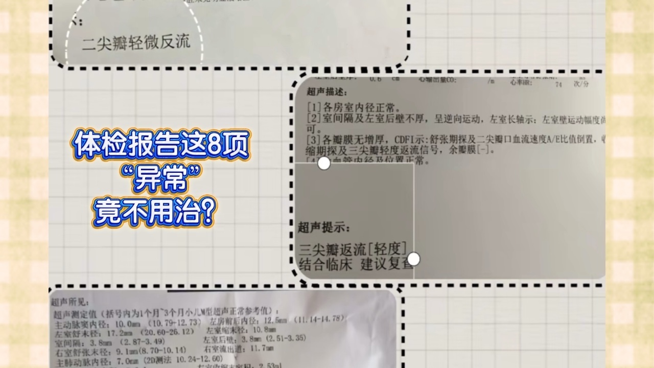 体检报告这8项“异常”，竟不用治？