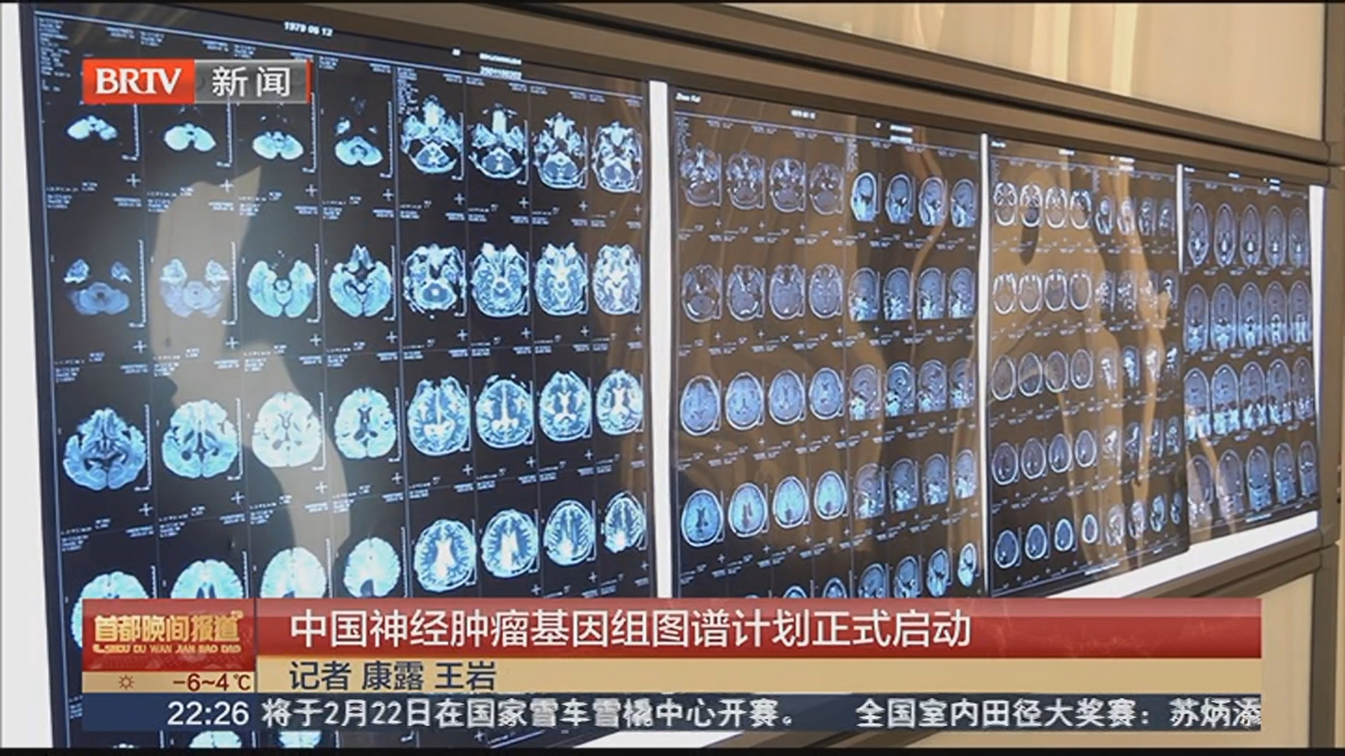 中国神经肿瘤基因组图谱计划正式启动 中国神经肿瘤基因组图谱计划正式启动