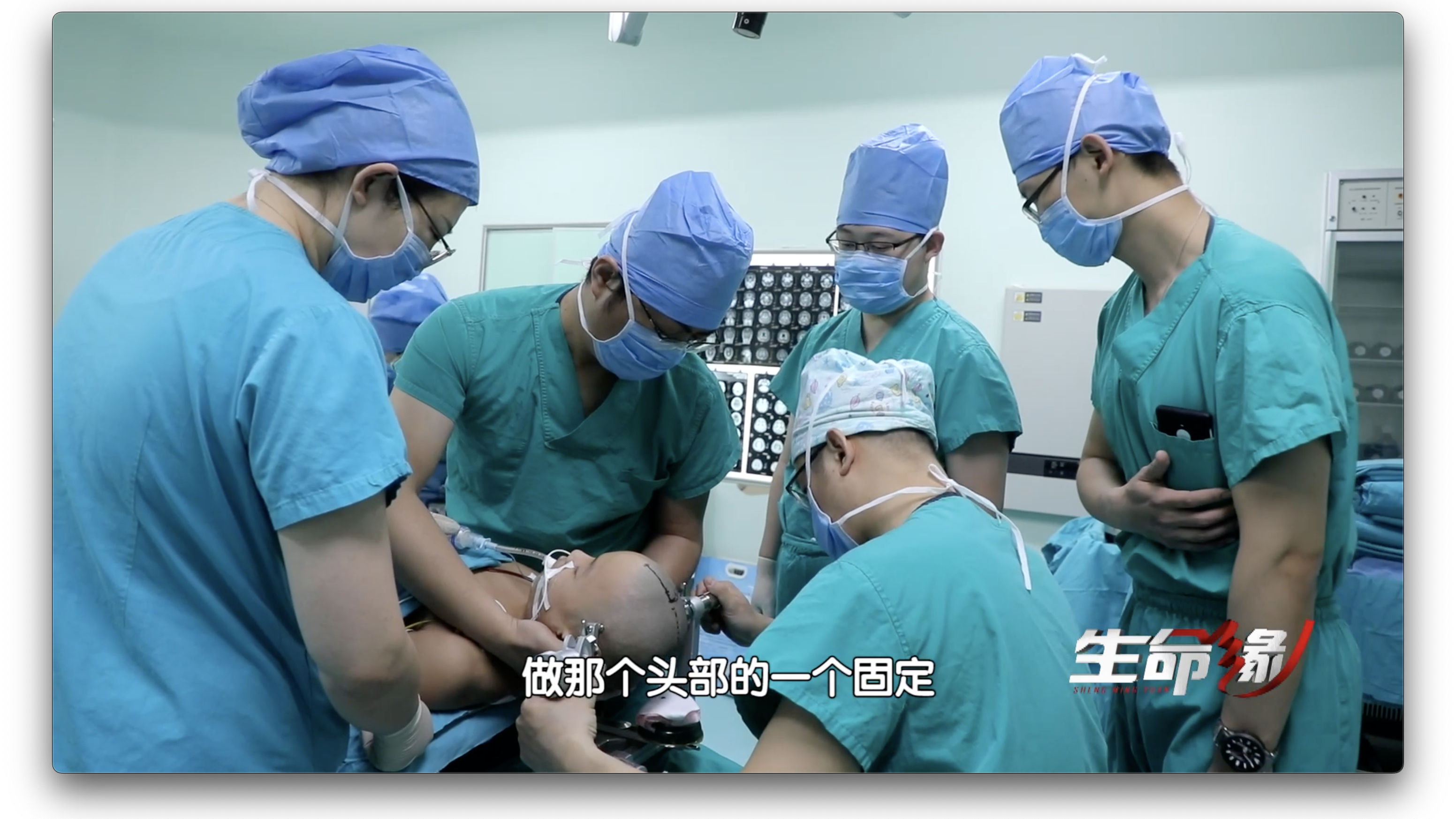 肿瘤长在颅内最核心位置松果体区,深度达到11厘米,手术难度可想而知 肿瘤长在颅内最核心位置松果体区,深度达到11厘米,手术难度可想而知