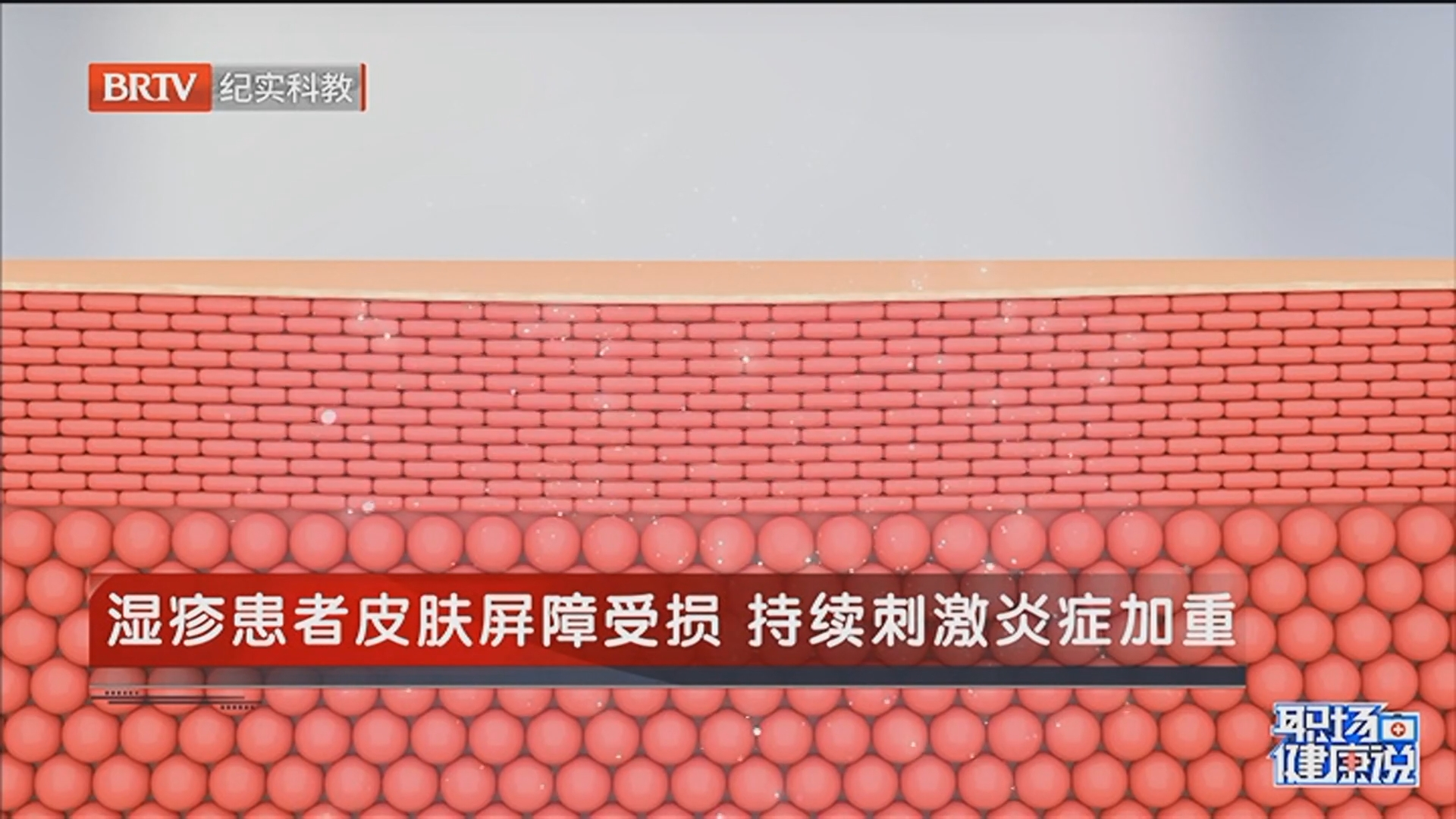 《职场健康说》20250911瘙痒——越抓越痒的痛苦循环
