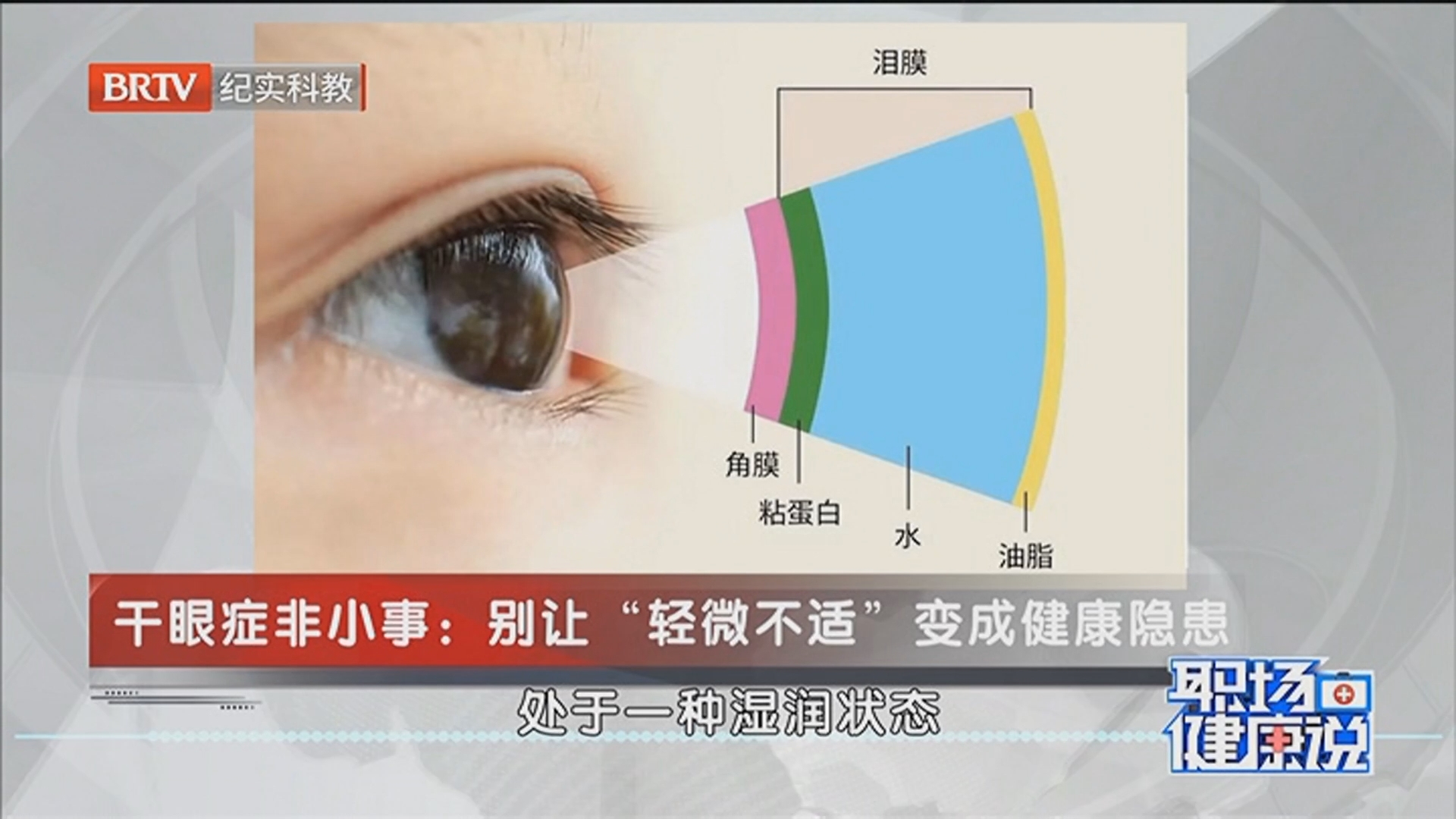 《职场健康说》20260526眼睛的小“干”扰——解码干眼症