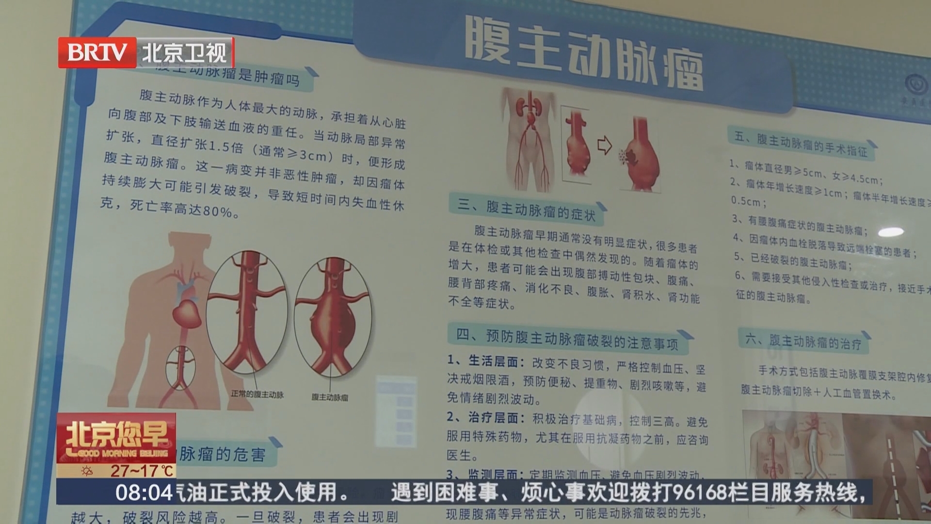 健康早知道 四条建议 远离血管“炸弹”
