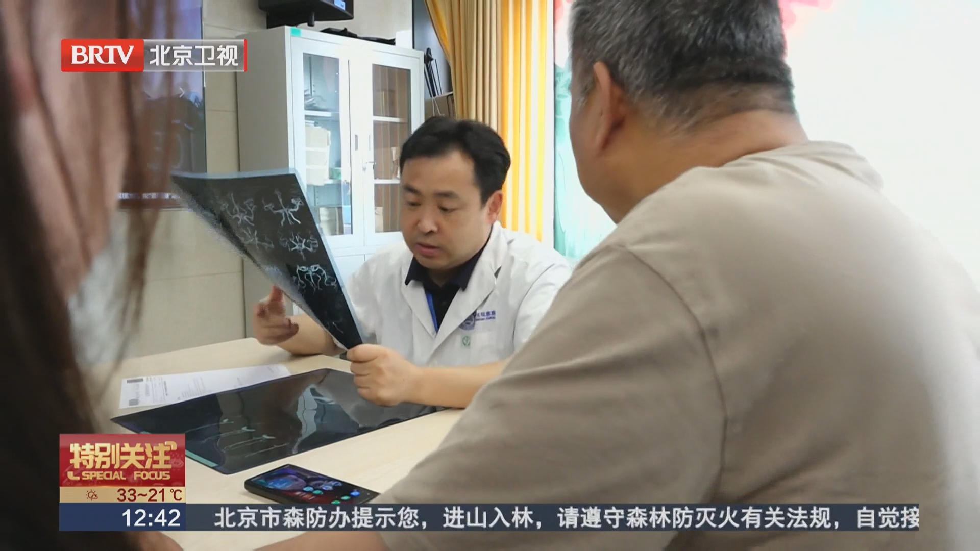 女性吸烟 警惕颅内动脉瘤