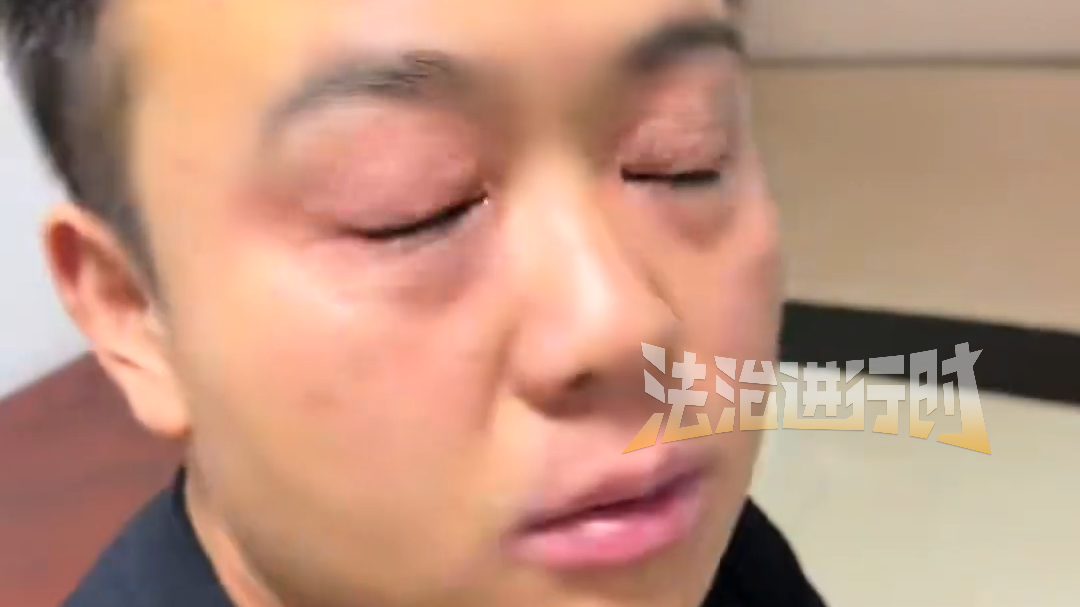 男子因蒿草严重过敏疑似吐血，赶紧开车往医院赶