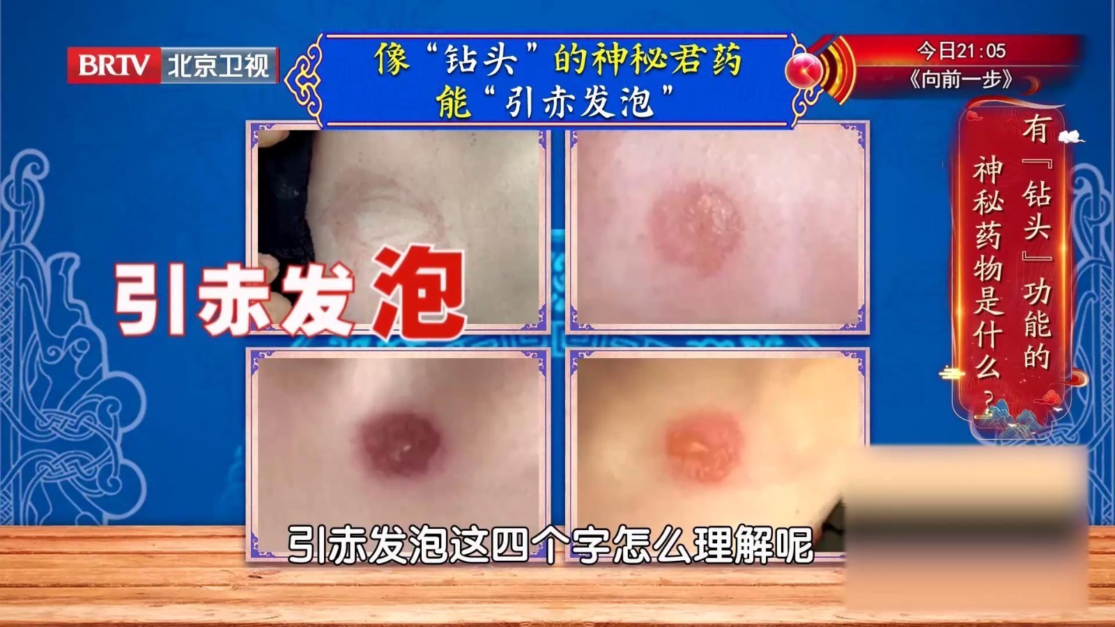 贴了三伏贴,皮肤发红、瘙痒、长水泡,还能接着贴吗? 贴了三伏贴,皮肤发红、瘙痒、长水泡,还能接着贴吗?