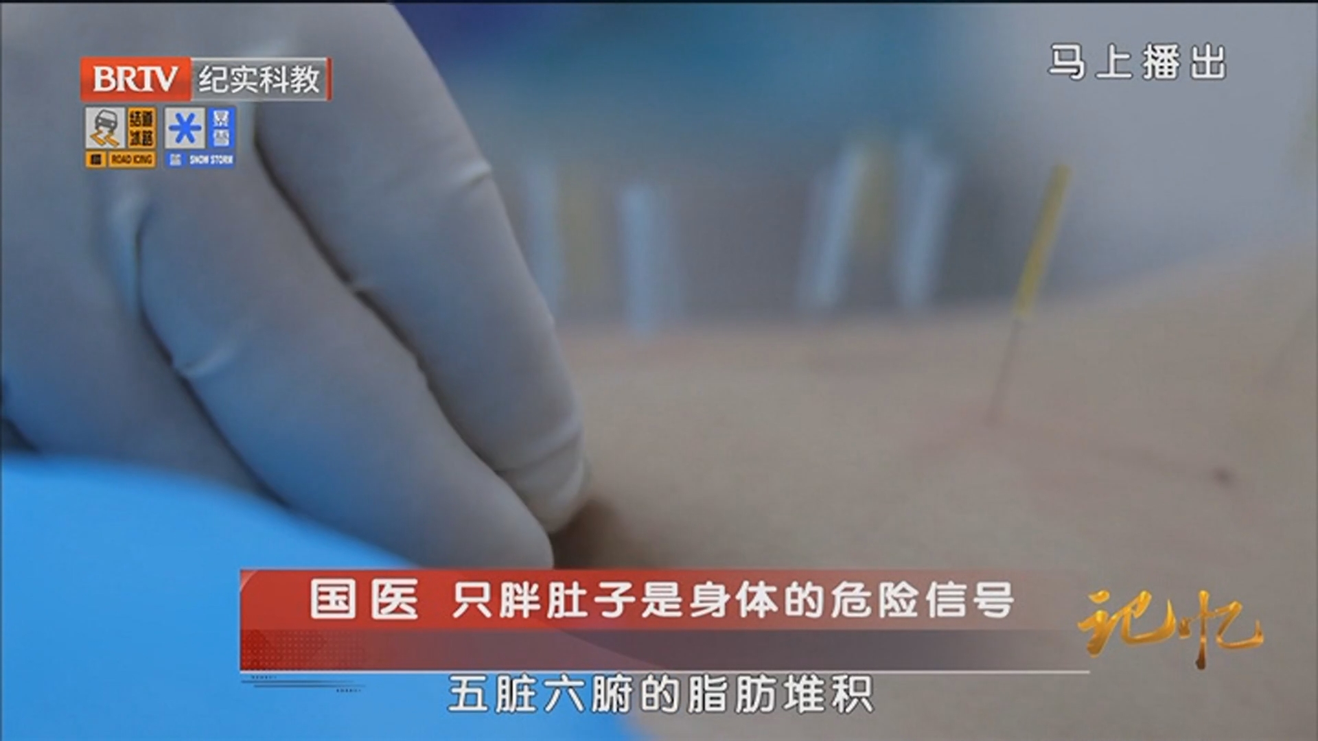 《记忆》20251212国医 只胖肚子是身体的危险信号