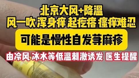 北京大风+降温,导致浑身痒,起疙瘩,可能是慢性自发荨麻疹 北京大风+降温,导致浑身痒,起疙瘩,可能是慢性自发荨麻疹