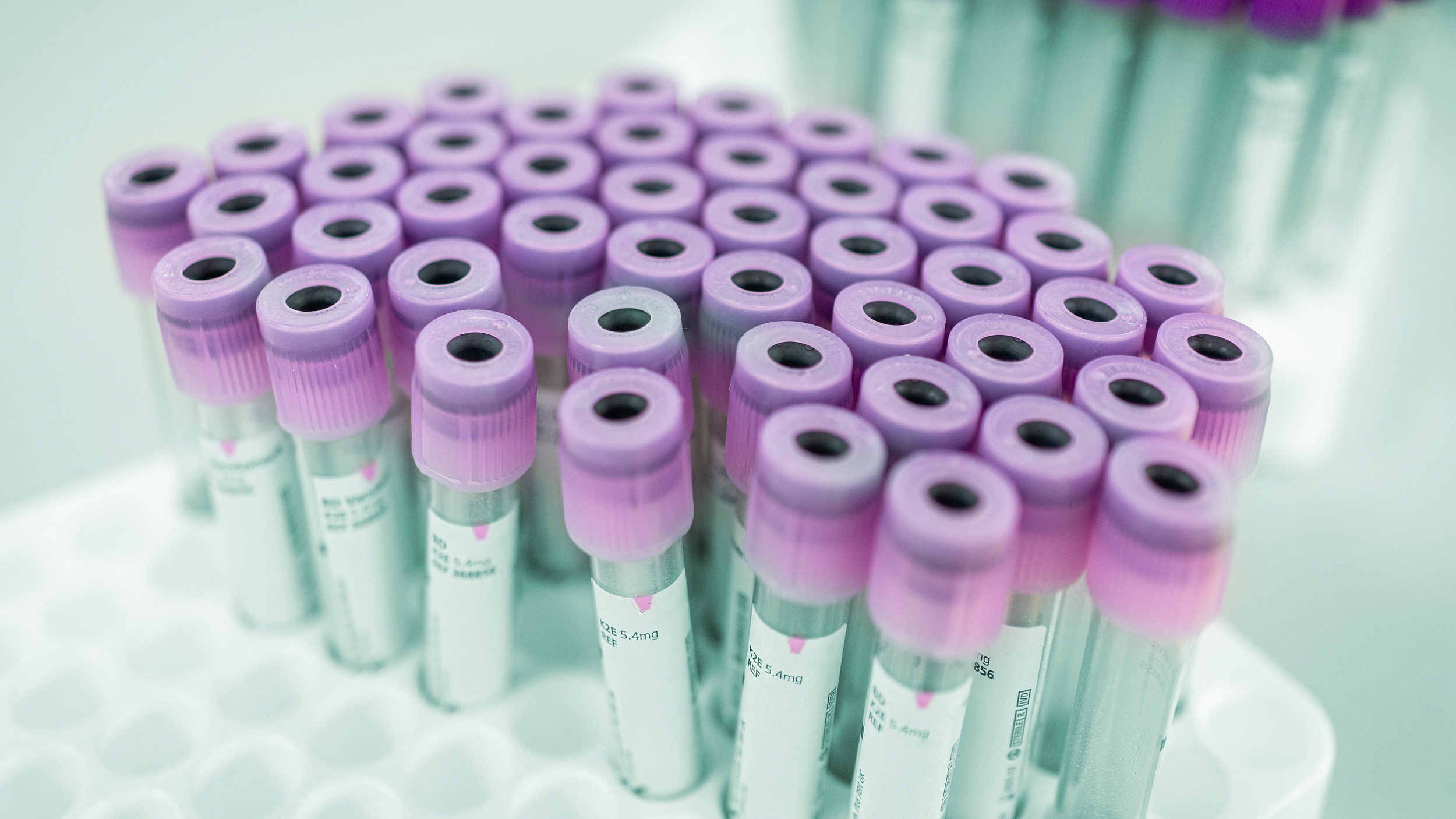 今日科普:血脂化验单有“↑”箭头,就是高血脂吗? 今日科普:血脂化验单有“↑”箭头,就是高血脂吗?