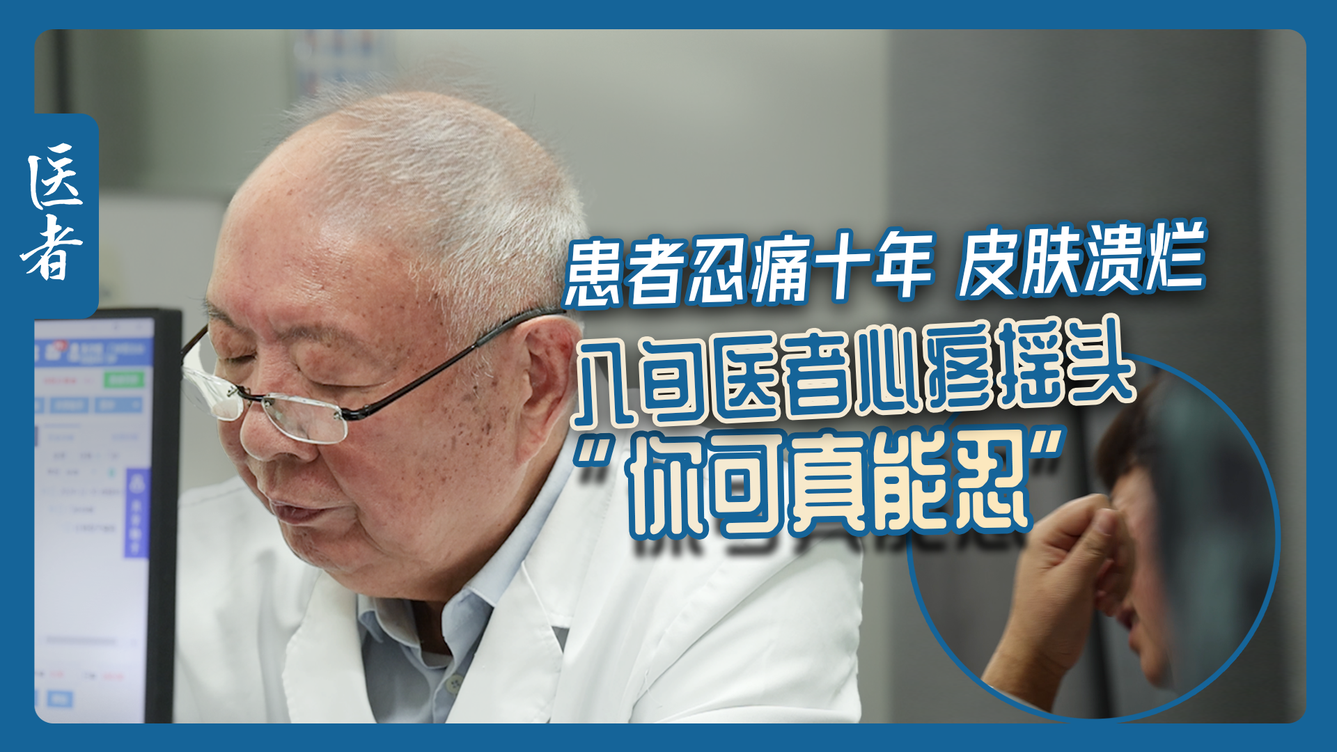 医者|患者忍痛十年 皮肤溃烂 八旬医者心疼摇头“你可真能忍” 医者|患者忍痛十年 皮肤溃烂 八旬医者心疼摇头“你可真能忍”