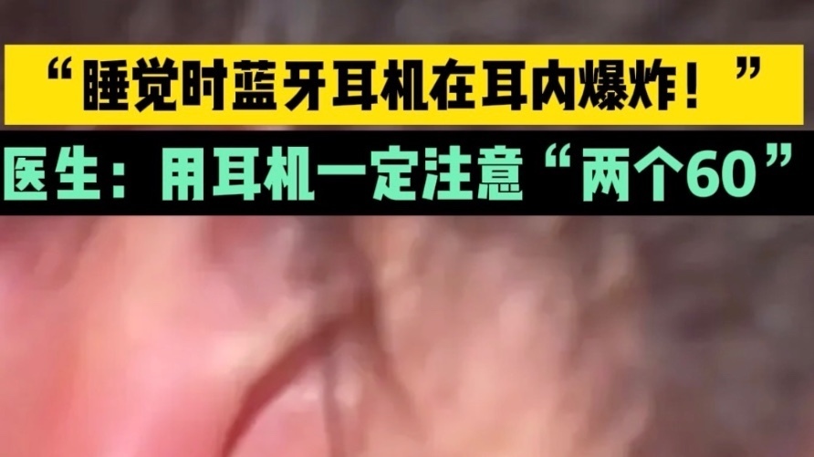 “睡觉时蓝牙耳机在耳内爆炸!”医生:用耳机一定注意“两个60” “睡觉时蓝牙耳机在耳内爆炸!”医生:用耳机一定注意“两个60”